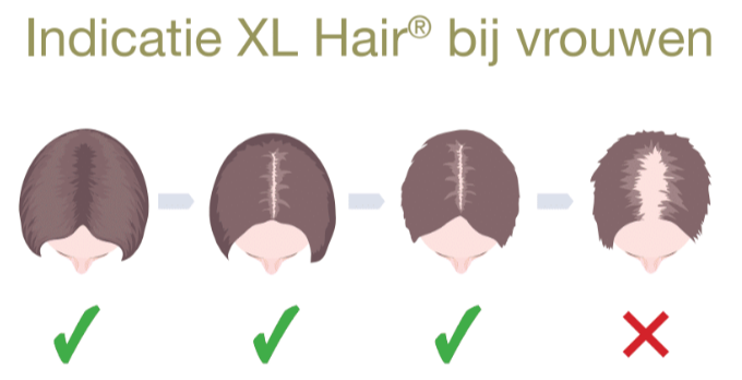 XL Hair vrouwen Amsterdam