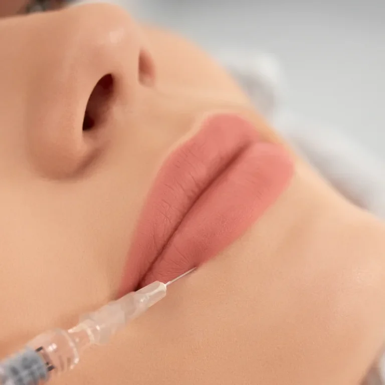 Fillers in Amsterdam